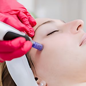Microneedles