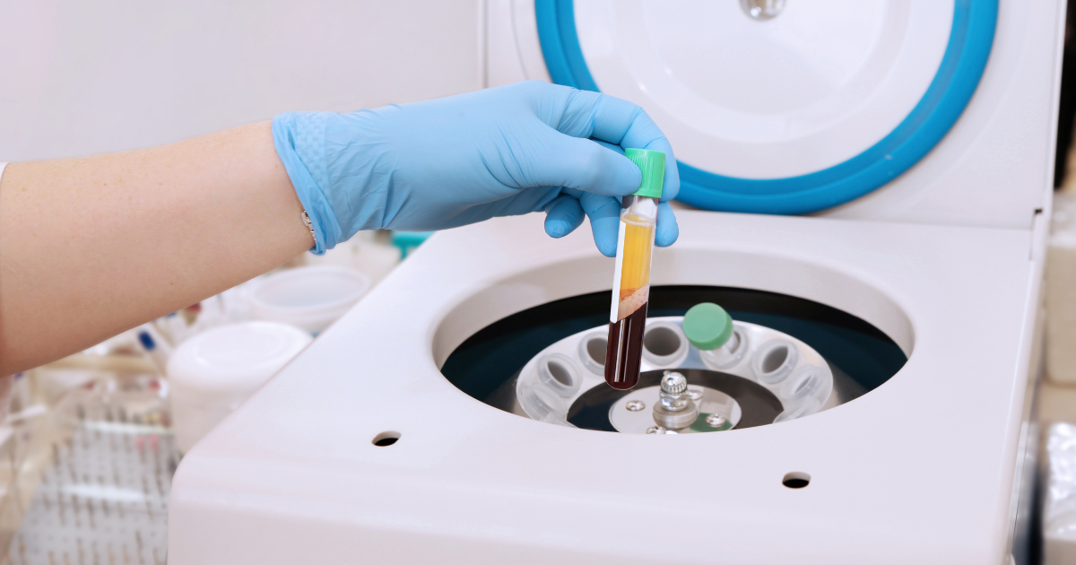 PRP in Centrifuge