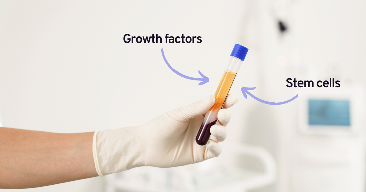 PRP platelet-rich plasma injection therapy