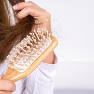 Hairloss alopecia naturopathic integrative vancouver