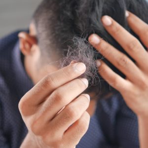 Platelet rich fibrin PRF hair loss integrative naturopathic vancouver towfiqu barbhuiya F Gq Eu M0wu Kk unsplash