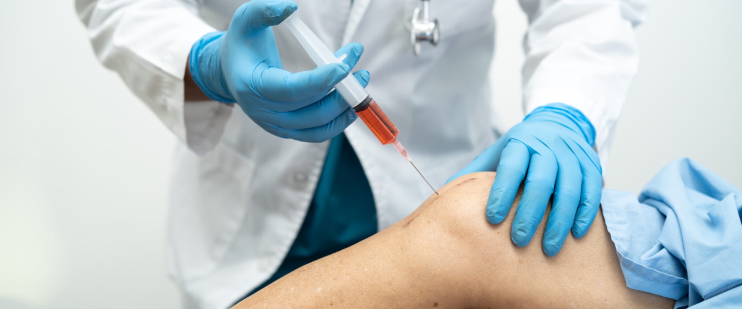 Platelet-Rich-Plasma Injection for Chronic Knee Pain
