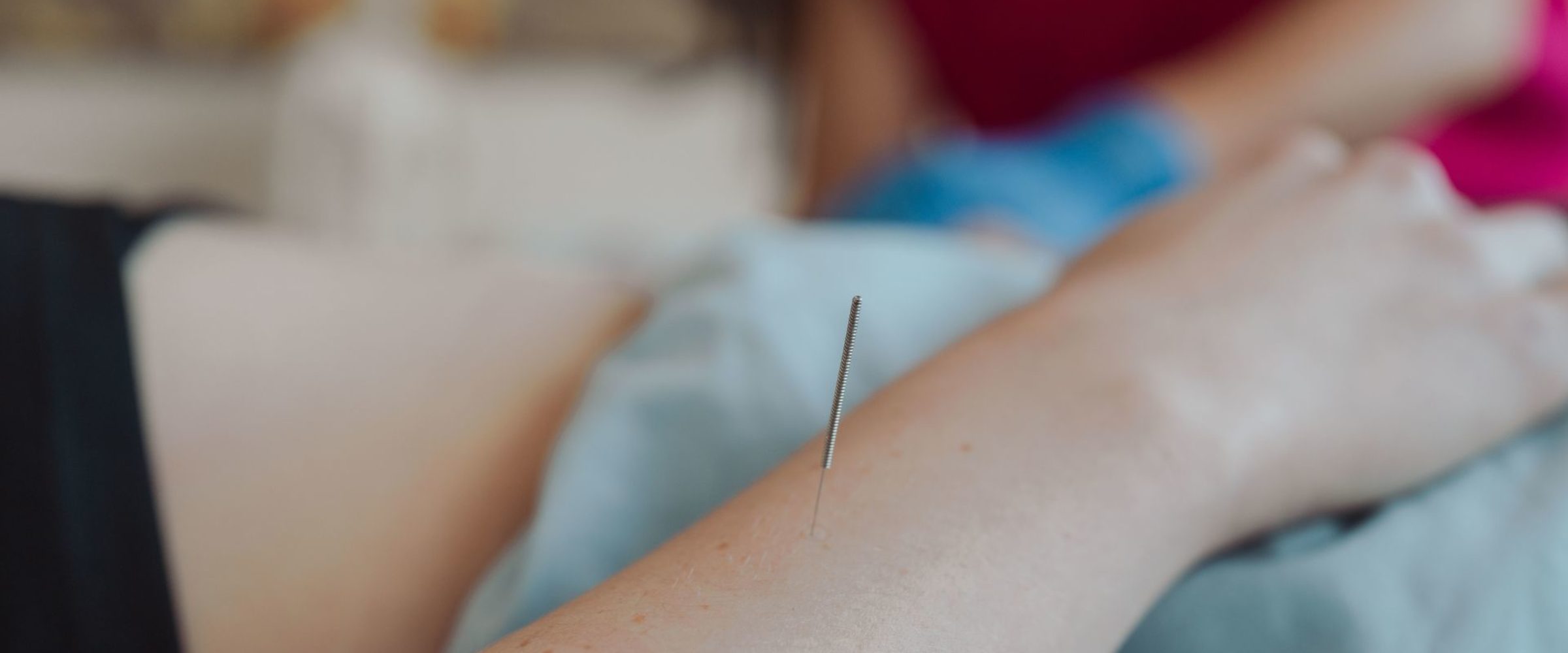 acupuncture needle up close